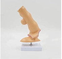 Modelo anatomico de esofago de Barrett patologias