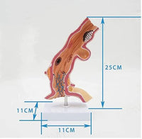 Modelo anatomico de esofago de Barrett patologias