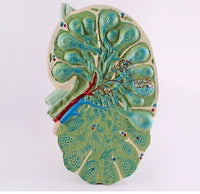 Modelo de agrandamiento de nódulos linfáticos humanos