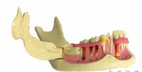 Modelo de descomposicion dental (mandibula derecha)