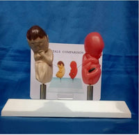 Modelo anatomico feto comparativo fumados Vs saludable