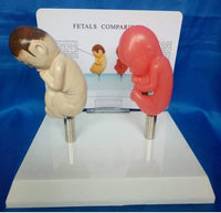 Modelo anatomico feto comparativo fumados Vs saludable