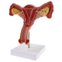 Modelo patologíco de utero y ovario humano