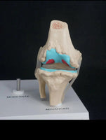 Anatomia degeneracion de rodilla - modelos anatomicos