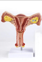 Modelo patologíco de utero y ovario humano