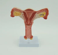 Modelo patologíco de utero y ovario humano