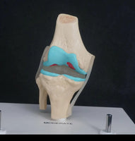 Anatomia degeneracion de rodilla - modelos anatomicos