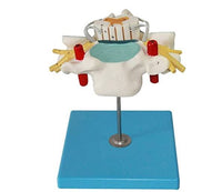 Modelo nervio cervical - espinal