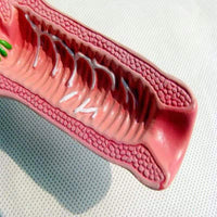 Modelo anatómico uterino - Enfermedad Vaginal Enf transmision sexual