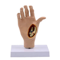 Modelo de Mano patologia tendon y ligamento osteoartritis