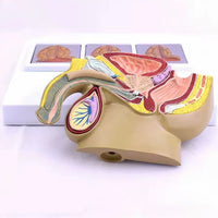 Modelo patológico de Prostata masculino