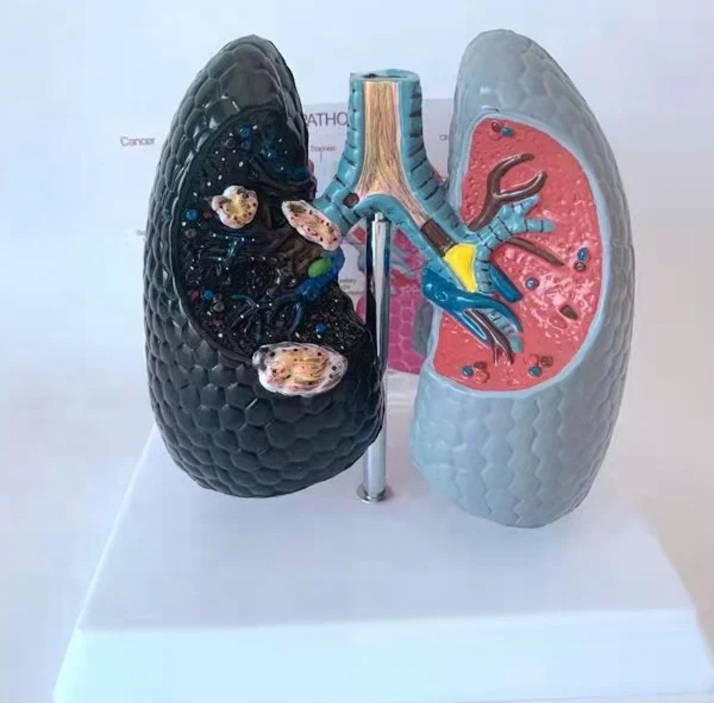 Modelo anatomico comparativo pulmon de fumador