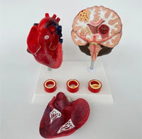 Modelo de corazon trombosis Vascular con Cerebro
