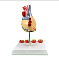 Modelo de anatomía del corazón humano con trombosis
