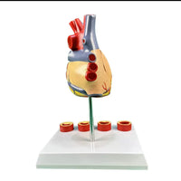 Modelo de anatomía del corazón humano con trombosis