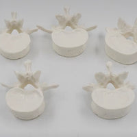 Modelo de anatomía 1:1 vértebra Lumbar cervical de 5 segmentos