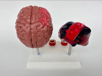 Modelo de corazon trombosis Vascular con Cerebro
