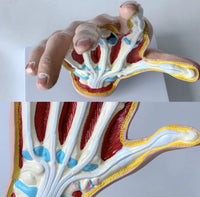 Modelo de Mano artritis reumatoide
