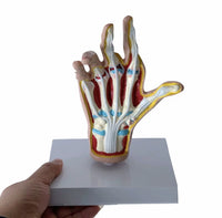 Modelo de Mano artritis reumatoide
