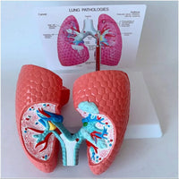 Modelo anatomico comparativo pulmon de fumador
