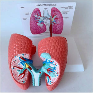 Modelo anatomico comparativo pulmon de fumador