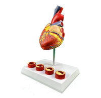 Modelo de anatomía del corazón humano con trombosis
