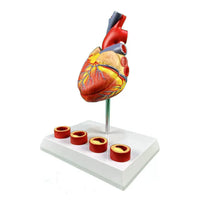 Modelo de anatomía del corazón humano con trombosis