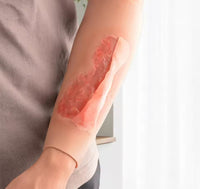 Simulador de heridas por raspadura
