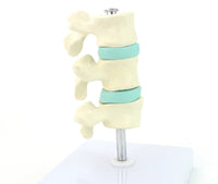 Anatomia osteoporosis intra-vertebral.
