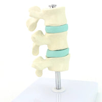 Anatomia osteoporosis intra-vertebral.