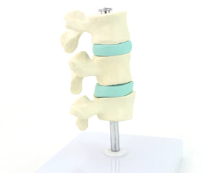 Anatomia osteoporosis intra-vertebral.