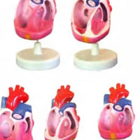 Modelo de malformación cardíaca congénita, simulador de entrenamiento médico de anatomía humana avanzada