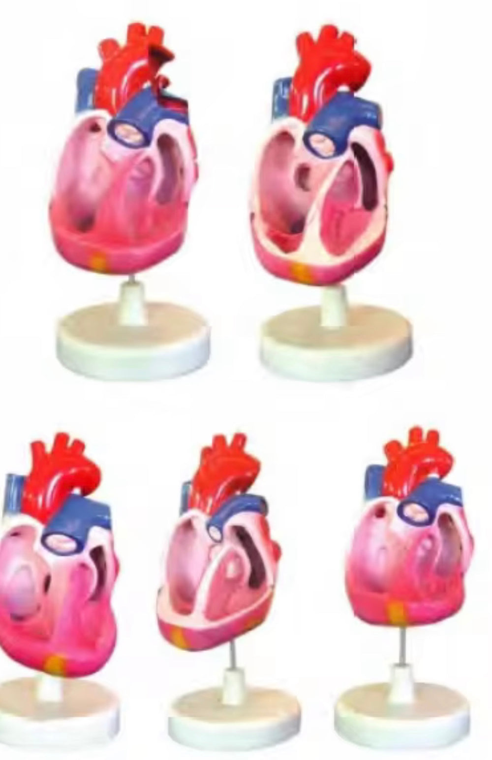 Modelo de malformación cardíaca congénita, simulador de entrenamiento médico de anatomía humana avanzada