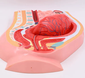 Modelo de desprendimiento separacion de placenta