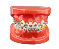 Modelo de implantes dentales
