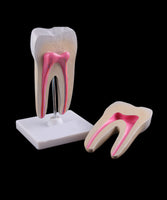 Estructura de molar humana saludable
