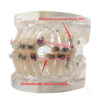 Modelo Dental - Tipodonto acrílico diferentes tipos practicas dentales