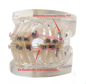 Modelo Dental - Tipodonto acrílico diferentes tipos practicas dentales