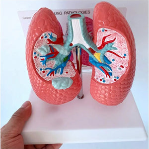 Modelo anatomico comparativo pulmon de fumador