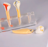 Modelo Dental de 5 etapas para tratamiento endodontico
