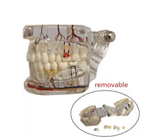 Modelo Dental - Tipodonto acrílico diferentes tipos practicas dentales
