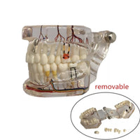 Modelo Dental - Tipodonto acrílico diferentes tipos practicas dentales