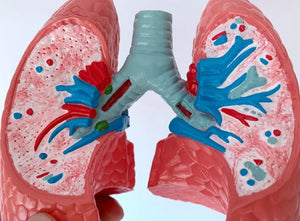 Modelo anatomico comparativo pulmon de fumador