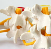 Modelo anatómico degeneracion lumbar vertebras
