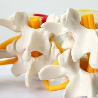 Modelo anatómico degeneracion lumbar vertebras