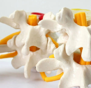 Modelo anatómico degeneracion lumbar vertebras