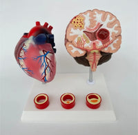 Modelo de corazon trombosis Vascular con Cerebro
