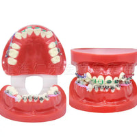 Modelo de implantes dentales
