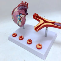 Modelo de corazon trombosis Vascular con arteria