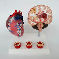 Modelo de corazon trombosis Vascular con Cerebro